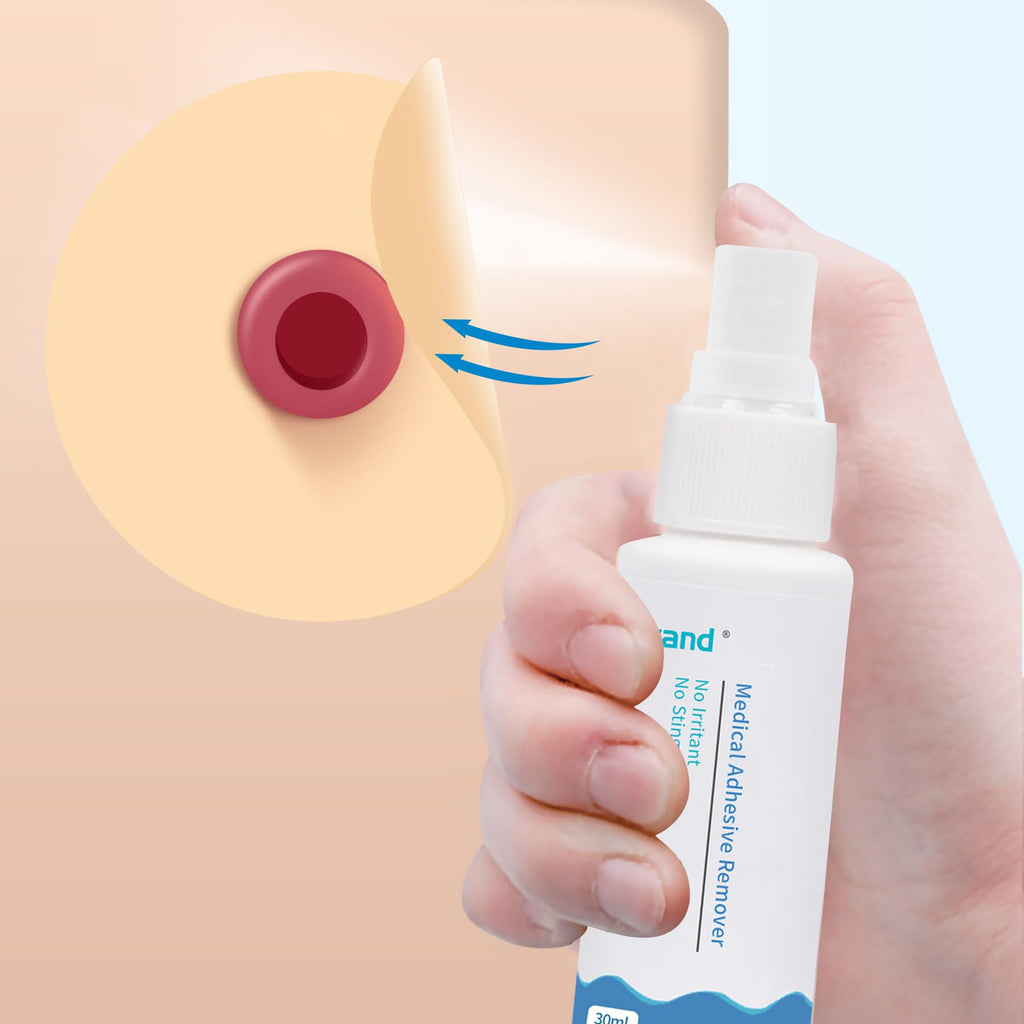 2oz Alcohol Free Sting Free Medical Adhesive Remover Spray U991629